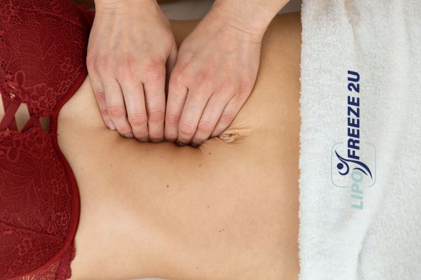 diastasis recti treatment Melton Mowbray