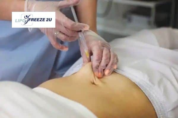 How Does Aqualyx Fat Dissolving Injection Work to Break Down Fat Melton Mowbray?