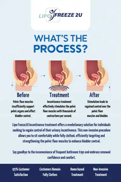 Diagram of how incontinence treatment Melton Mowbray works.