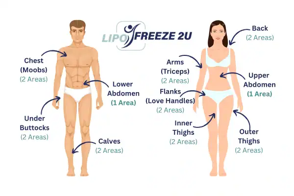 Areas you can have fat freezing treatment Melton Mowbray