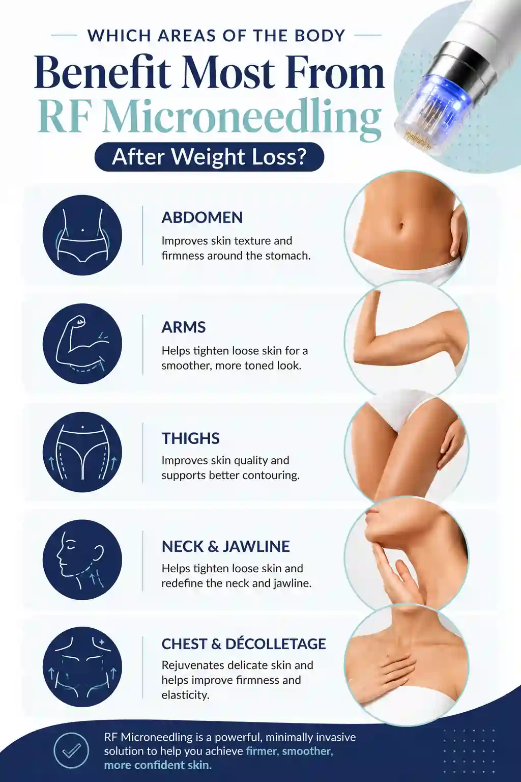 Which Areas of the Body Benefit Most From RF Microneedling After Weight Loss Melton Mowbray